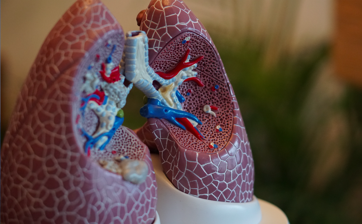 Aumento da sobrevida global do câncer de pulmão EGFR-mutado